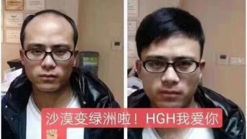 Hgh凝胶是正规的吗怎么代理产品图片
